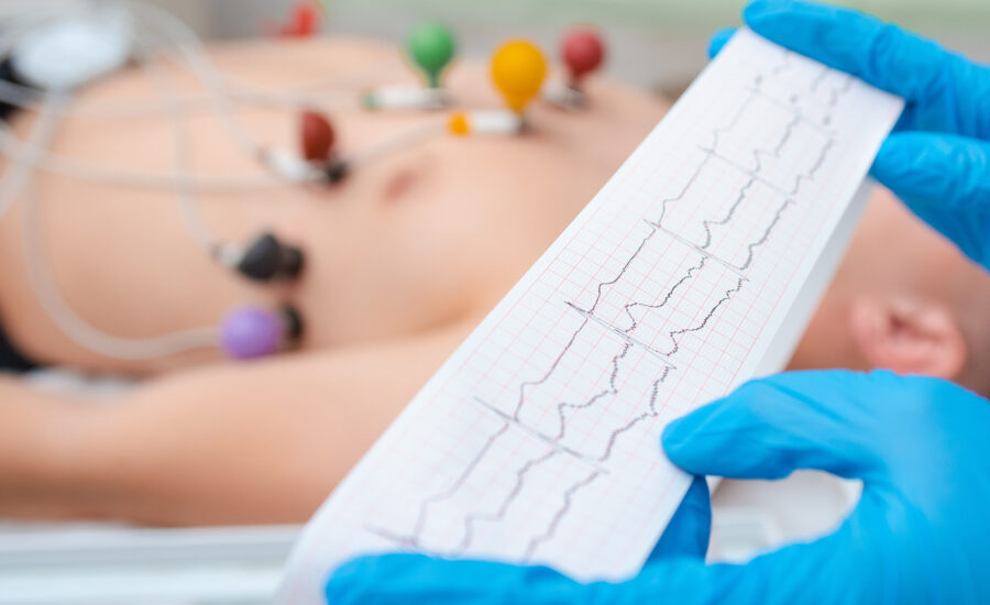 come riconoscere aritmina cardiaca