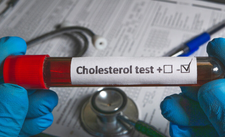 colesterolo alto